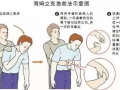 海姆立克急救法视频,关键时刻的救命技能详解